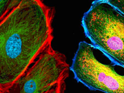 ���Ծ�ӫ����������������������Ч��������������������������ӫ����΢ʵ�顢���⹲�۽���΢ʵ�顢ӫ��ԭλ�ӽ���FISH���������΢ʵ���